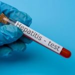 Masyarakat Nganjuk Diimbau Segera ke Faskes Jika Bergejala Hepatitis Akut